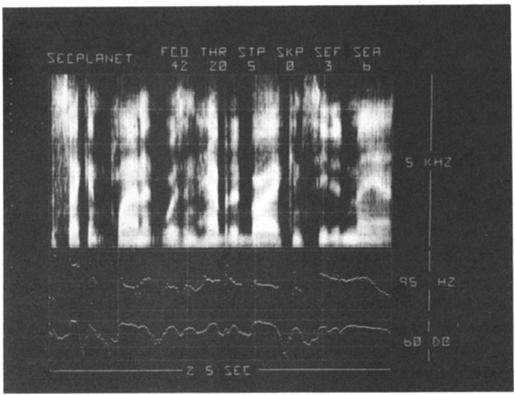 Figure 10 is a section of/a /in "man" taken at a time of 2400 msec with some nasal influence apparent. C.