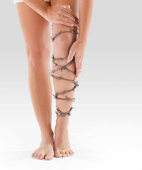 You don t have to live with the pain of varicose veins.