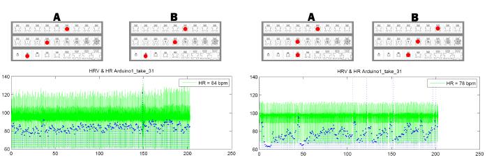 Figure 6: Heart Rate and Heart Rate Variability of two audience members compared to their Self-Assessment Manikin (SAM) before and after listening to a live musical performance.
