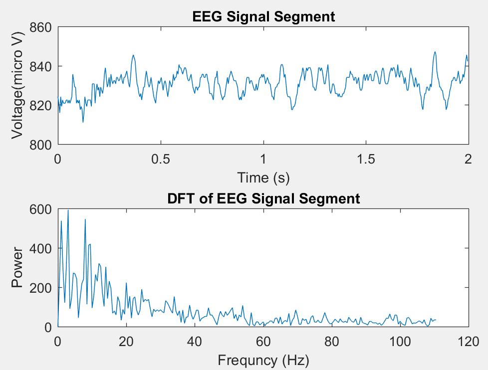 Figure 4: A two-second segment of EEG signal obtained from the Muse headband and the DFT of the segment are plotted.
