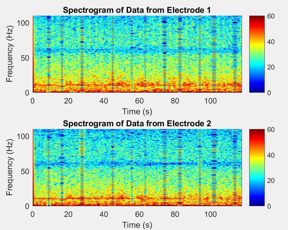 Figure 11: Spectrogram of the EEG signals while the subject was relaxed with Hamming window with window length of 440 samples and overlap of 330 samples.