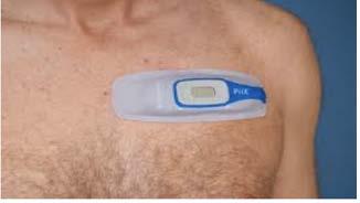 Corventis: Wireless Cardiac Monitor PiiX wearable sensor enables continuous monitoring for ambulatory patients, providing clinicians with insight into patient cardiovascular health during normal