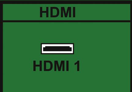 Connecting Your DVD Player You have several options for connecting your DVD player to your HDTV: HDMI, Component, S-Video and Composite (AV) inputs.