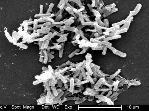 Clostridium difficile Clostridium difficile is a spore-forming, Grampositive anaerobic bacillus that is naturally found in the intestinal tract of humans and animals, and in the environment.
