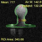 Coil: Neurovascular Mfg.: Invivo Mfg. Date: //27 Coil ID: Phantom: Invivo NVA Phantom Test Date: 6//28 Model: 422 32 383 SN: 476 # of Channels 6 3 2 C 3 28.