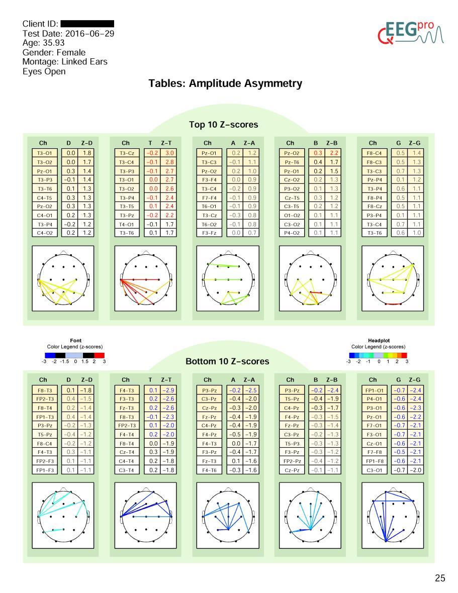 20. Tables: Amplitude Asymmetry Section 17 of the qeeg-pro report shows two tables containing the top and bottom 10 Amplitude Asymmetry data and the z-scored Amplitude Asymmetry, for 4 frequency