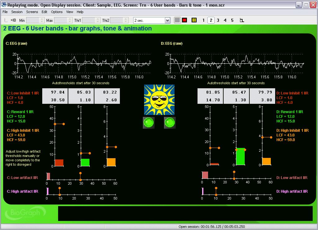 Training - Bars and Tone - 1 This category of screens can be used for training up-to 6 different EEG bands set up as one reward and two inhibits on each side.