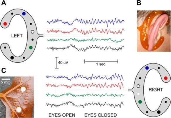 USE CASES IN SCIENTIFIC PAPERS SMARTPHONE EEG This study presents first evidence that reliable EEG data can be recorded with a new ceegrid electrode array, which consists of ten electrodes printed on