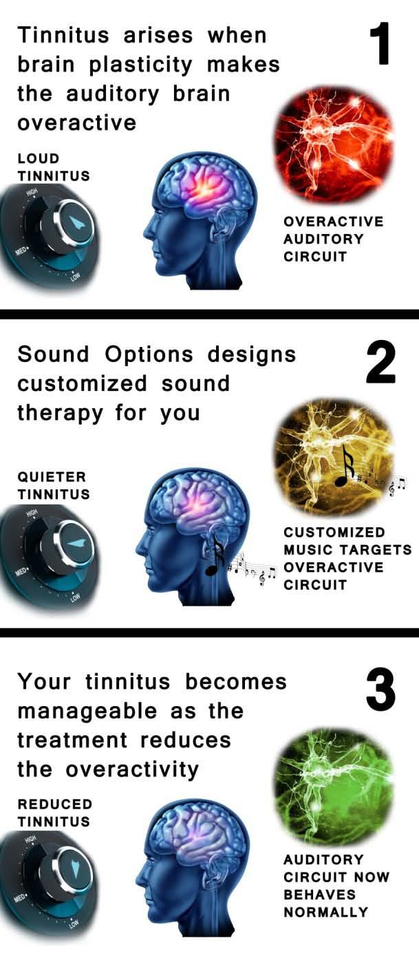 The software then predicts and creates a custom-built sound therapy that can minimize or undo these changes.