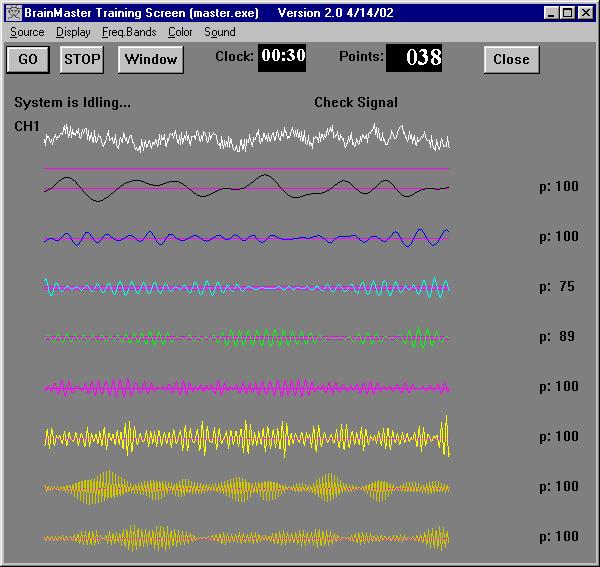 3.4 Filtered Waveforms Pane This option displays the filtered waveforms in the same window as the raw EEG.