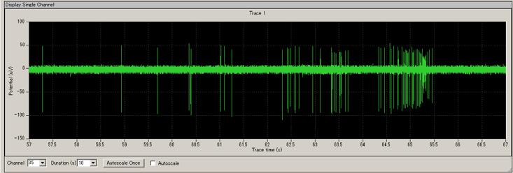 3-1. Recording spontaneous neuronal spikes (single unit) Scales can be changed during recording.