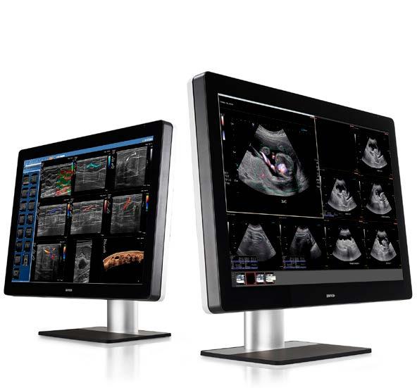 Change your reading room dynamics 33 2800 px 4200 px One display. Any image. 66% of radiologists want to see colors and grays on the same screen.