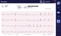 With rolling paper Reliable Analysis utilises the University of Glasgow ECG analysis algorithm, one of the world-leading