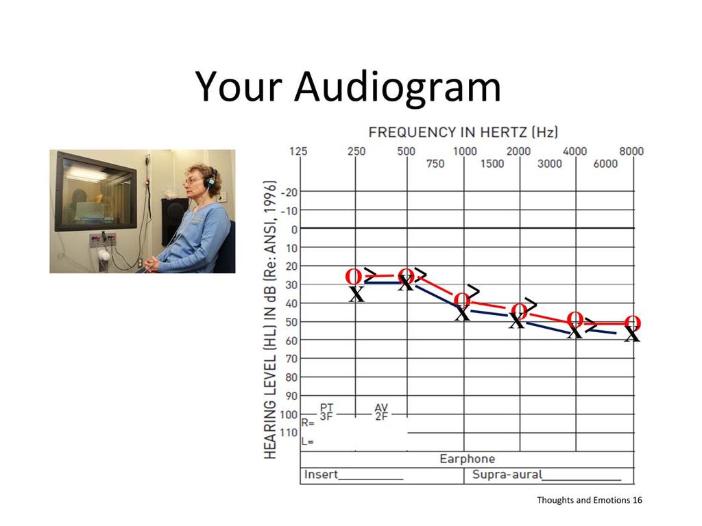 Review pt s audiogram Point out