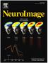 NeuroImage 61 (2012) Contents lists available at SciVerse ScienceDirect. NeuroImage. journal homepage: